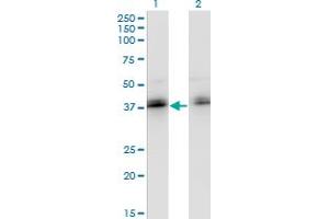 Western Blot analysis of ZNF444 expression in transfected 293T cell line by ZNF444 monoclonal antibody (M02), clone 4E9.