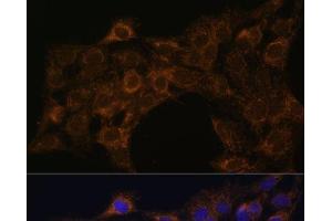 Immunofluorescence analysis of C6 cells using FoxO3a Polyclonal Antibody at dilution of 1:100. (FOXO3 Antikörper)