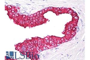 Immunohistochemistry staining of human prostate (paraffin section) using anti-cytokeratin 5+18 (clone). (Keratin 5/8 Antikörper)