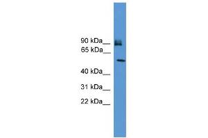 WB Suggested Anti-OSBPL11 Antibody Titration:  0.