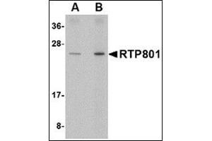 Western blot analysis of RTP801 in human kidney tissue lysate with this product at (A) 0. (DDIT4 Antikörper  (Center))