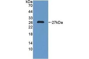 Detection of Recombinant NXN, Human using Polyclonal Antibody to Nucleoredoxin (NXN) (NXN Antikörper  (AA 166-327))