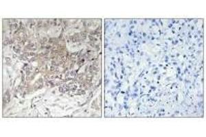 Immunohistochemistry (IHC) image for anti-Glucosaminyl (N-Acetyl) Transferase 3, Mucin Type (GCNT3) antibody (ABIN7183573)