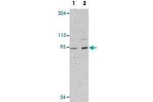 Western blot analysis of human heart tissue with LZTR1 polyclonal antibody  at (Lane 1) 1 and (Lane 2) 2 ug/mL dilution. (LZTR1 Antikörper  (N-Term))