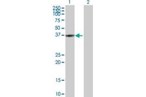 Western Blot analysis of BLVRA expression in transfected 293T cell line by BLVRA MaxPab polyclonal antibody. (Biliverdin Reductase Antikörper  (AA 1-296))