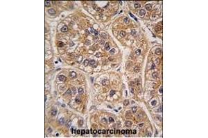 Immunohistochemistry (Paraffin-embedded Sections) (IHC (p)) image for anti-Aldo-Keto Reductase Family 1, Member A1 (Aldehyde Reductase) (AKR1A1) (AA 293-325), (C-Term) antibody (ABIN389204)