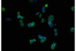Immunofluorescence (IF) image for anti-Cadherin 1, Type 1, E-Cadherin (Epithelial) (CDH1) (AA 155-707) antibody (ABIN7146194)