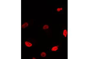Immunofluorescent analysis of c-Myc staining in Jurkat cells. (c-MYC Antikörper  (C-Term))