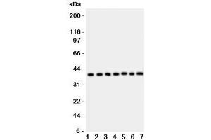 Western blot testing of ARA9 antibody and Lane 1:  HeLa;  2: COLO320;  3: HT1080;  4: MCF-7;  5: SW620;  6: U87;  7: MM231;  Predicted/Observed size: 37KD (AIP Antikörper  (AA 91-330))