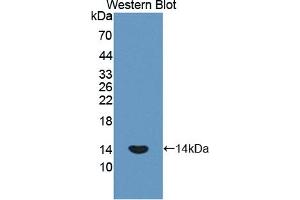 Detection of Recombinant PLOD1, Human using Polyclonal Antibody to Procollagen Lysine-1,2-Oxoglutarate-5-Dioxygenase 1 (PLOD1) (PLOD1 Antikörper  (AA 636-727))