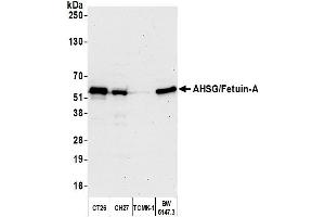 Western Blotting (WB) image for anti-alpha-2-HS-Glycoprotein (AHSG) (AA 25-75) antibody (ABIN7449953) (Fetuin A Antikörper  (AA 25-75))