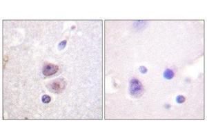 Immunohistochemistry (IHC) image for anti-Mitogen-Activated Protein Kinase 14 (MAPK14) antibody (ABIN1847989) (MAPK14 Antikörper)