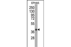 Western blot analysis of anti-EPHA5 Monoclonal Antibody (ABIN387809 and ABIN2843902) by EPHA5 recombinant protein (Fragment). (EPH Receptor A5 Antikörper)