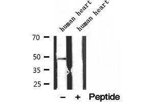 Western blot analysis of extracts of human heart tissue, using ATPB antibody. (ATP5B Antikörper  (Internal Region))
