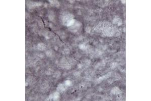 IHC on rat brain (free floating sections) using Rabbit antibody to VGluT1  at a concentration of 30 µg/ml. (SLC17A7 Antikörper)