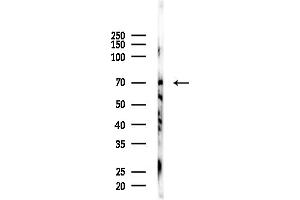 anti-Glutaminase (GLS) (C-Term) antibody