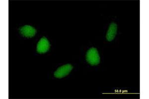 Immunofluorescence of purified MaxPab antibody to NUDT6 on HepG2 cell. (NUDT6 Antikörper  (AA 1-316))
