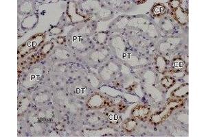 Expression of TRPV5 in rat kidney - Immunohistochemical staining of rat kidney paraffin embedded section using Anti-TRPV5 Antibody (ABIN7043855, ABIN7043996 and ABIN7043997), (1:100). (TRPV5 Antikörper  (C-Term, Intracellular))