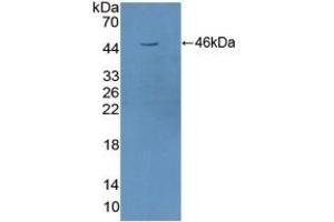 Detection of Recombinant STAM2, Human using Polyclonal Antibody to Signal Transducing Adaptor Molecule 2 (STAM2) (STAM2 Antikörper  (AA 1-377))