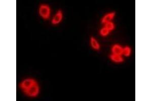 Immunofluorescent analysis of RAB5A staining in Hela cells. (RAB5 Antikörper)
