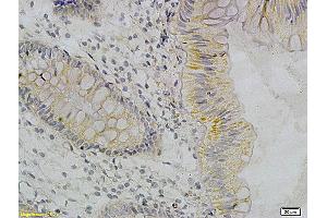 Immunohistochemistry (IHC) image for anti-Tumor Necrosis Factor alpha (TNF alpha) antibody (ABIN722481) (TNF alpha Antikörper)