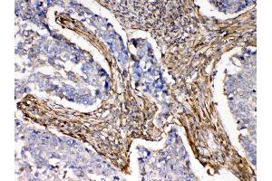 Immunohistochemistry (IHC) image for anti-Actinin, alpha 3 (ACTN3) (AA 574-617), (C-Term) antibody (ABIN4886420)
