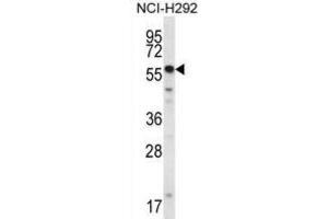 Western Blotting (WB) image for anti-SET and MYND Domain Containing 2a (SMYD2A) antibody (ABIN2995651)