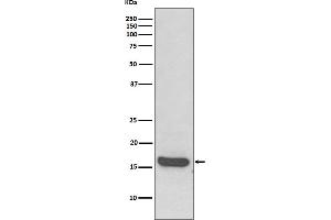 Western blot analysis of MAP1LC3A expression in Human brain lysate.
