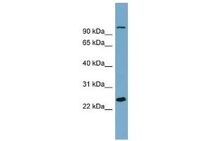 SEMA3D antibody used at 1 ug/ml to detect target protein. (SEMA3D Antikörper  (Middle Region))
