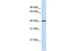 Western Blotting (WB) image for anti-Cytochrome P450, Family 4, Subfamily F, Polypeptide 12 (CYP4F12) (Middle Region) antibody (ABIN2783904)