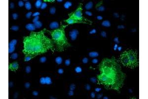 Anti-KATNB1 mouse monoclonal antibody (ABIN2455210) immunofluorescent staining of COS7 cells transiently transfected by pCMV6-ENTRY KATNB1 (RC201852). (KATNB1 Antikörper)