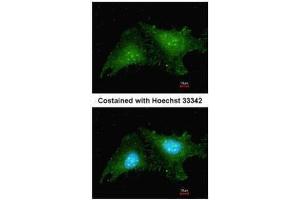 ICC/IF Image Immunofluorescence analysis of methanol-fixed HeLa, using RNF25, antibody at 1:200 dilution. (RNF25 Antikörper  (C-Term))
