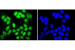 HeLa cells were stained with SIRT1(T530) (6H5) Monoclonal Antibody  at [1:200] incubated overnight at 4C, followed by secondary antibody incubation, DAPI staining of the nuclei and detection. (SIRT1 Antikörper  (pThr530))