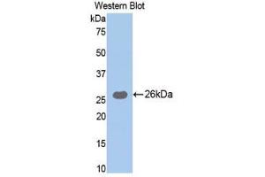 Western Blotting (WB) image for anti-Trypsin (AA 9-231) antibody (ABIN1077670) (Trypsin Antikörper  (AA 9-231))