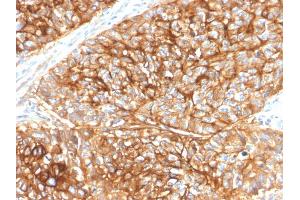 Immunohistochemistry (IHC) image for anti-CD9 (CD9) antibody (ABIN6941086)