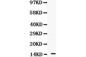 Observed bind size: 15KD (S100A11 Antikörper  (AA 2-105))