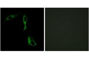 Immunofluorescence analysis of HeLa cells, using ADRA1D Antibody. (ADRA1D Antikörper  (AA 451-500))