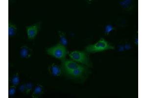 Anti-KLHL2 mouse monoclonal antibody (ABIN2453211) immunofluorescent staining of COS7 cells transiently transfected by pCMV6-ENTRY KLHL2 (RC205347). (KLHL2 Antikörper  (AA 1-100, AA 494-593))