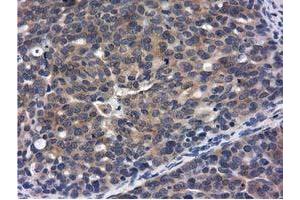 Immunohistochemistry (IHC) image for anti-COBW Domain Containing 1 (CBWD1) antibody (ABIN1497117) (CBWD1 Antikörper)