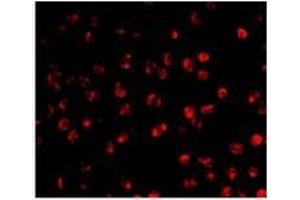 Immunofluorescence of AID in Ramos cells with AP30028PU-N Ramos antibody at 20 μg/ml. (AICDA Antikörper  (C-Term))
