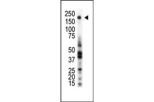 Western Blotting (WB) image for anti-Macrophage Stimulating 1 Receptor (C-Met-Related tyrosine Kinase) (MST1R) (AA 1370-1400), (AA 22-51) antibody (ABIN392048)
