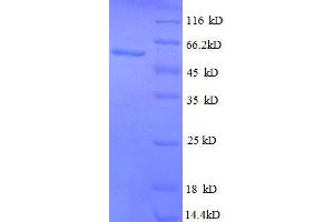 Activated Leukocyte Cell Adhesion Molecule (ALCAM) (AA 28-516), (partial) protein (His tag)
