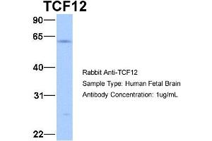 Host:  Rabbit  Target Name:  TCF12  Sample Type:  Human Fetal Brain  Antibody Dilution:  1. (TCF12 Antikörper  (N-Term))
