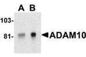 Western Blotting (WB) image for anti-ADAM Metallopeptidase Domain 10 (ADAM10) antibody (ABIN2478644) (ADAM10 Antikörper)