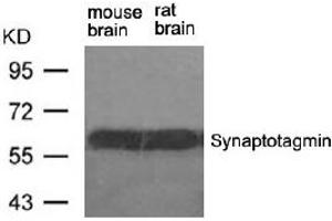Image no. 2 for anti-Synaptotagmin I (SYT1) (Ser309) antibody (ABIN401634) (SYT1 Antikörper  (Ser309))