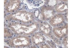 DAB staining on IHC-P; Samples: Human Kidney Tissue (PTTG1IP Antikörper  (AA 33-96))