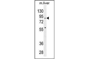 Western blot analysis in mouse liver tissue lysates (35 µg/lane) using SPIRE2 antibody (Center) Cat. (SPIRE2 Antikörper  (Middle Region))