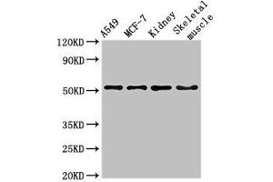 Western Blot Positive WB detected in: A549 whole cell lysate, MCF-7 whole cell lysate, Mouse kidney tissue, Mouse skeletal muscle tissue All lanes: NARF antibody at 3 μg/mL Secondary Goat polyclonal to rabbit IgG at 1/50000 dilution Predicted band size: 52, 57, 46, 45 kDa Observed band size: 52 kDa (NARF Antikörper  (AA 10-41))