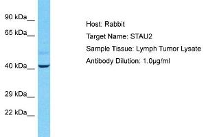 Host: Rabbit Target Name: STAU2 Sample Tissue: Human Lymph Tumor Antibody Dilution: 1ug/ml (Double-stranded RNA-binding protein Staufen homolog 2 (STAU2) (C-Term) Antikörper)