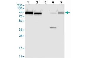 Western blot analysis of Lane 1: RT-4, Lane 2: U-251 MG, Lane 3: Human Plasma, Lane 4: Liver, Lane 5: Tonsil with FAM129B polyclonal antibody  at 1:250-1:500 dilution. (MEG3 Antikörper)